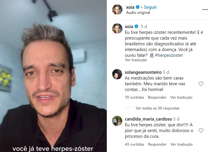 reporter da globo com herpes zoster