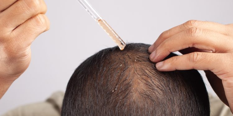 Minoxidil, como funciona - Men's Health Brasil